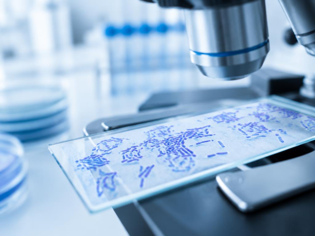 Bacteria on a microscope slide under a laboratory microscope — Narine strain in childhood leukemia research